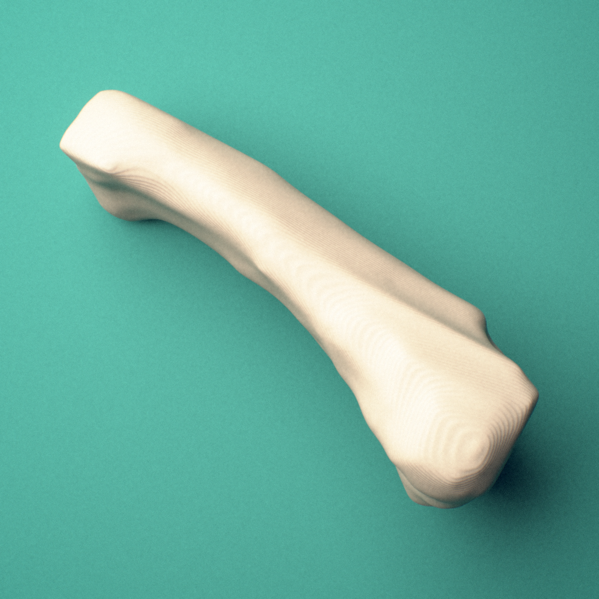 3D-printed Right little finger proximal phalanx, oblique view showing the base and head (trochlea).