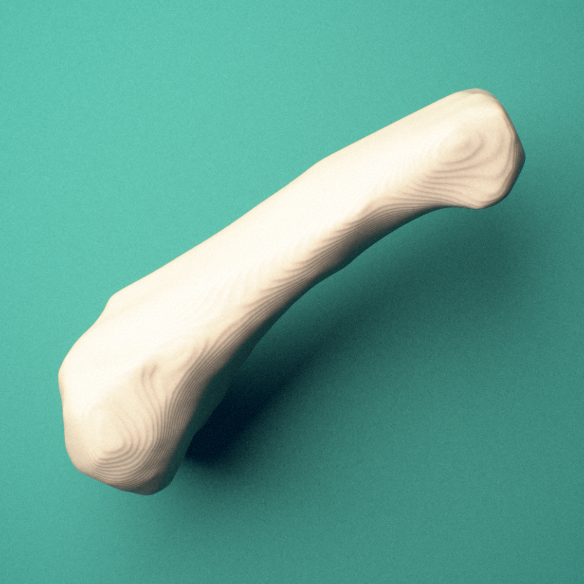 3D-printed Right little finger proximal phalanx, close-up view showing the base.