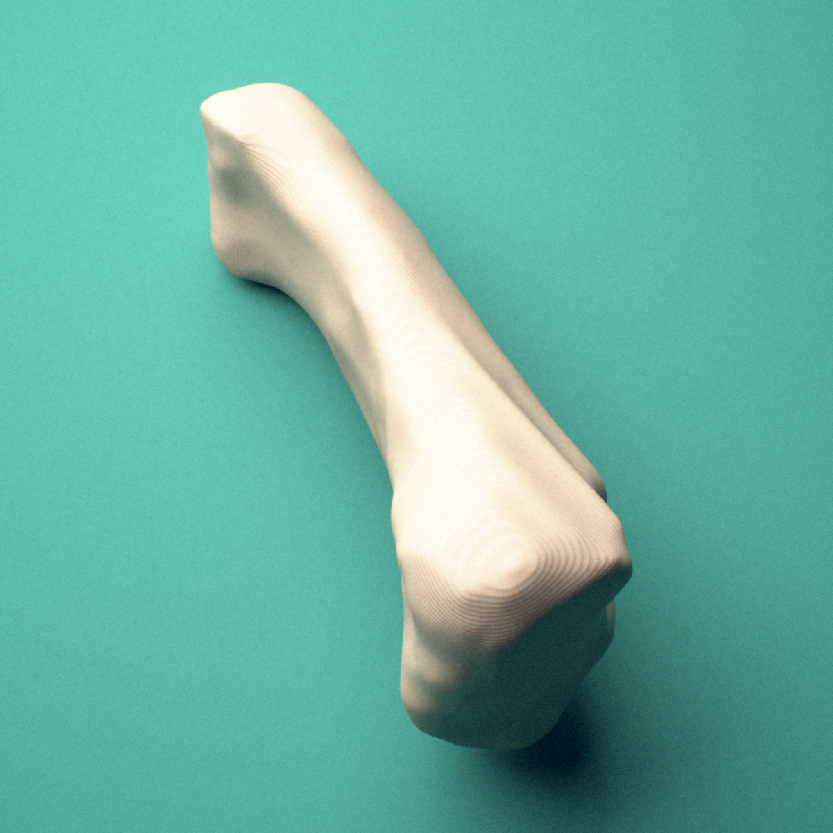 3D-printed Right little finger proximal phalanx, close-up view showing the head (trochlea).