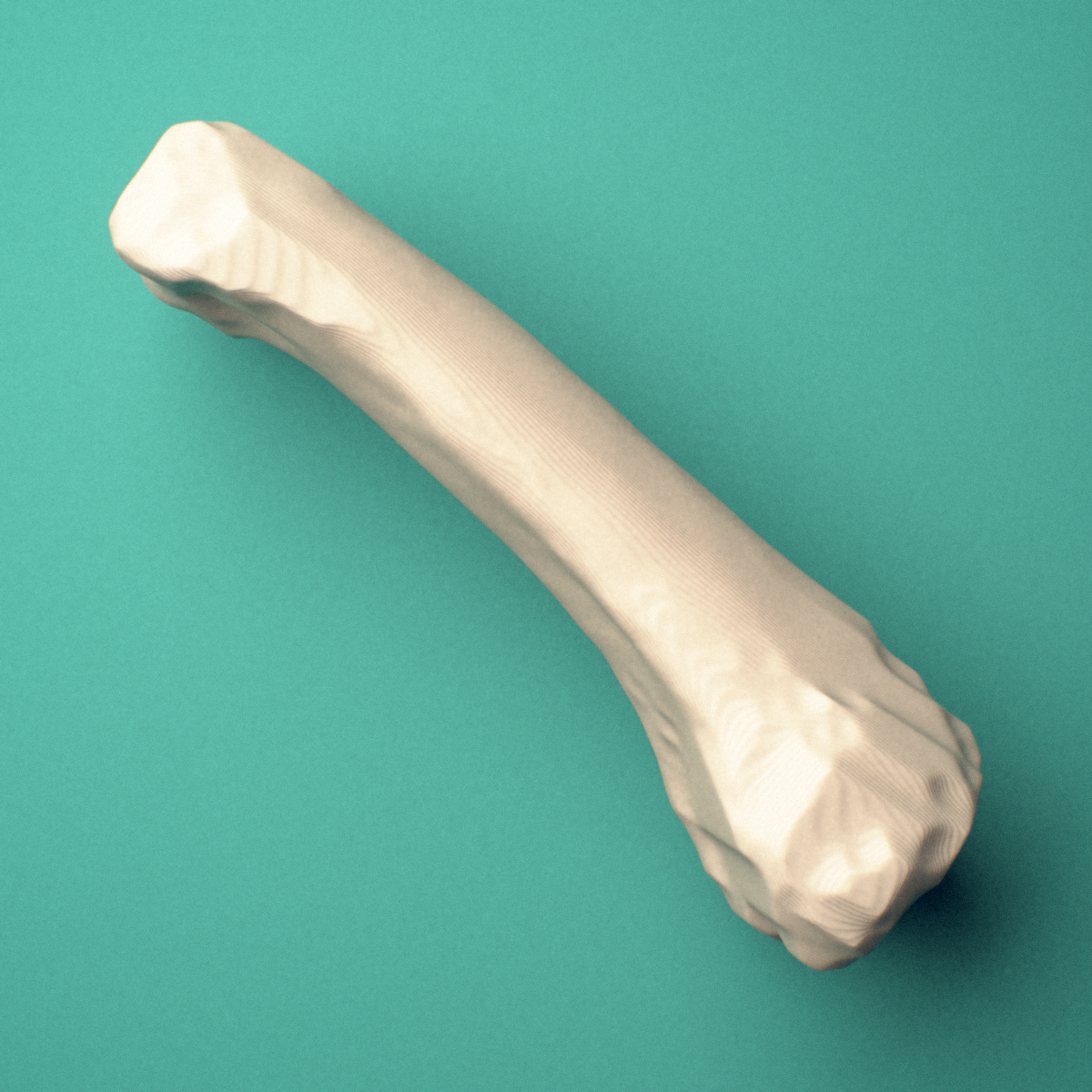 3D-printed Left middle finger proximal phalanx, oblique view showing the base and head (trochlea).