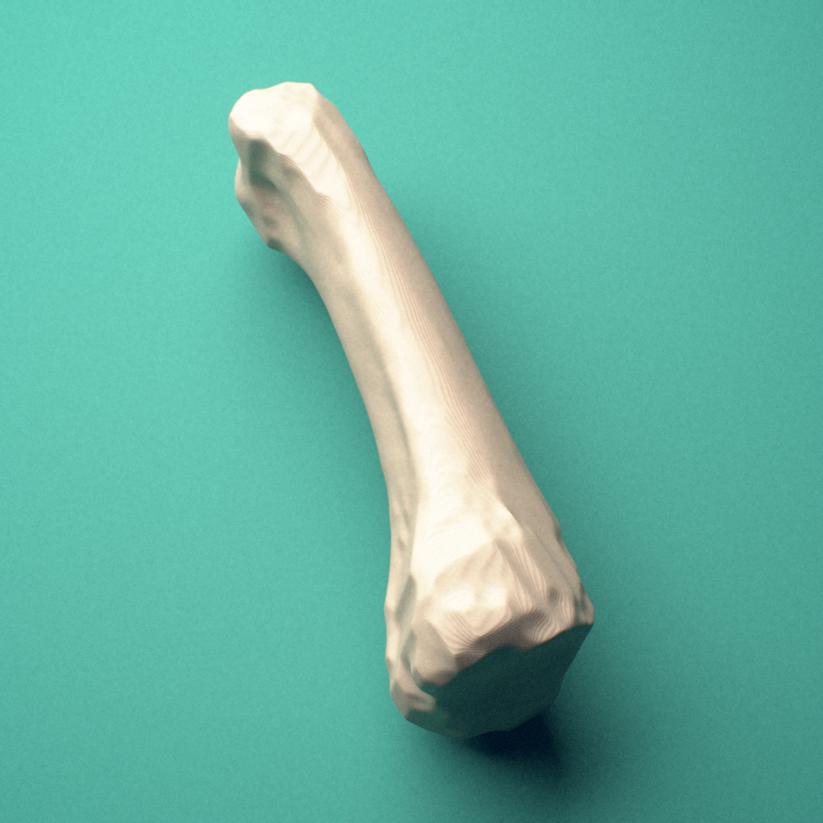 3D-printed Left middle finger proximal phalanx, close-up view showing the head (trochlea).