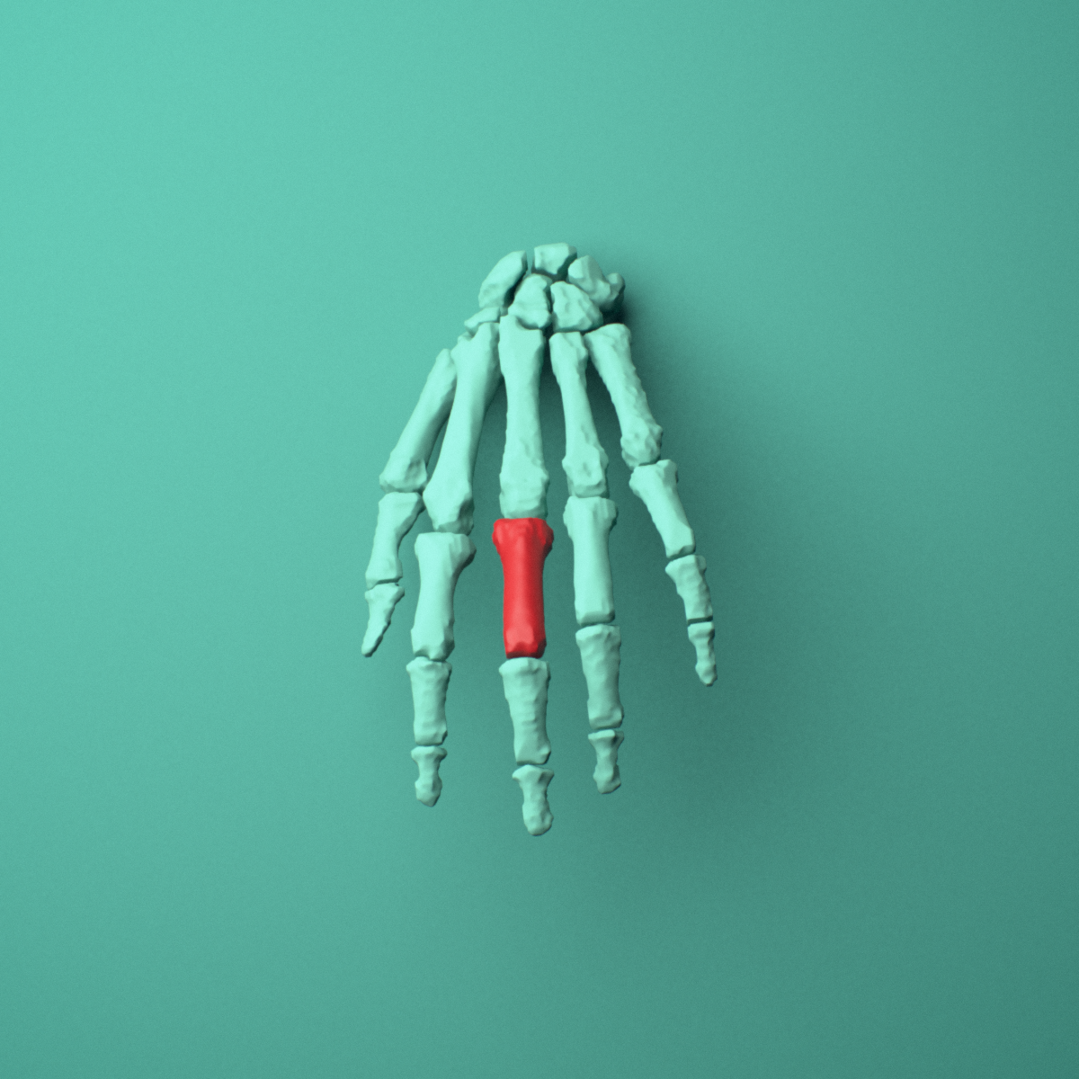 3D model of the Left middle finger proximal phalanx shown in position within a full hand and wrist model, anterior view.