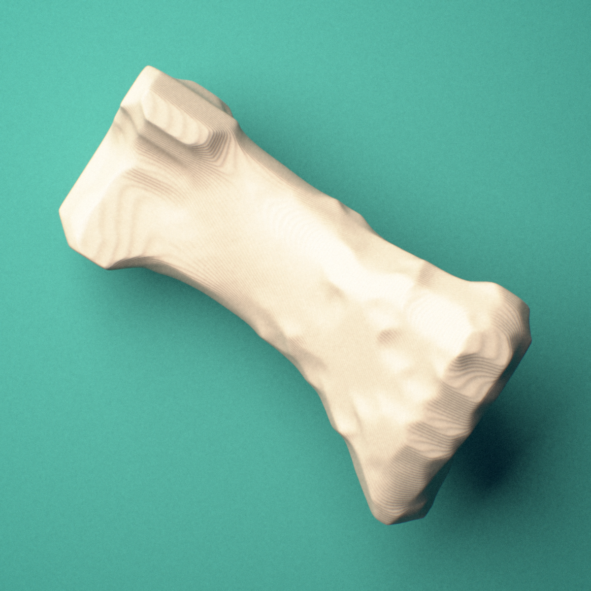 3D-printed Left thumb proximal phalanx, oblique view showing the base and head (trochlea).