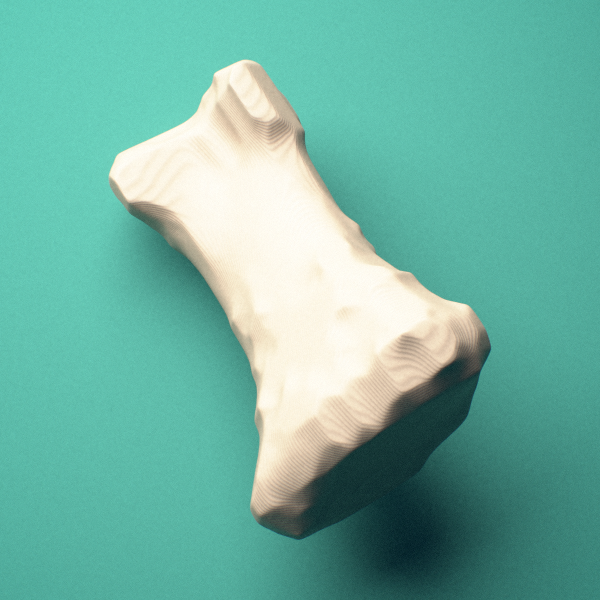 3D-printed Left thumb proximal phalanx, close-up view showing the head (trochlea).