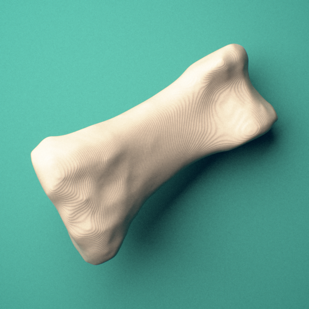 3D-printed Right thumb proximal phalanx, close-up view showing the base.