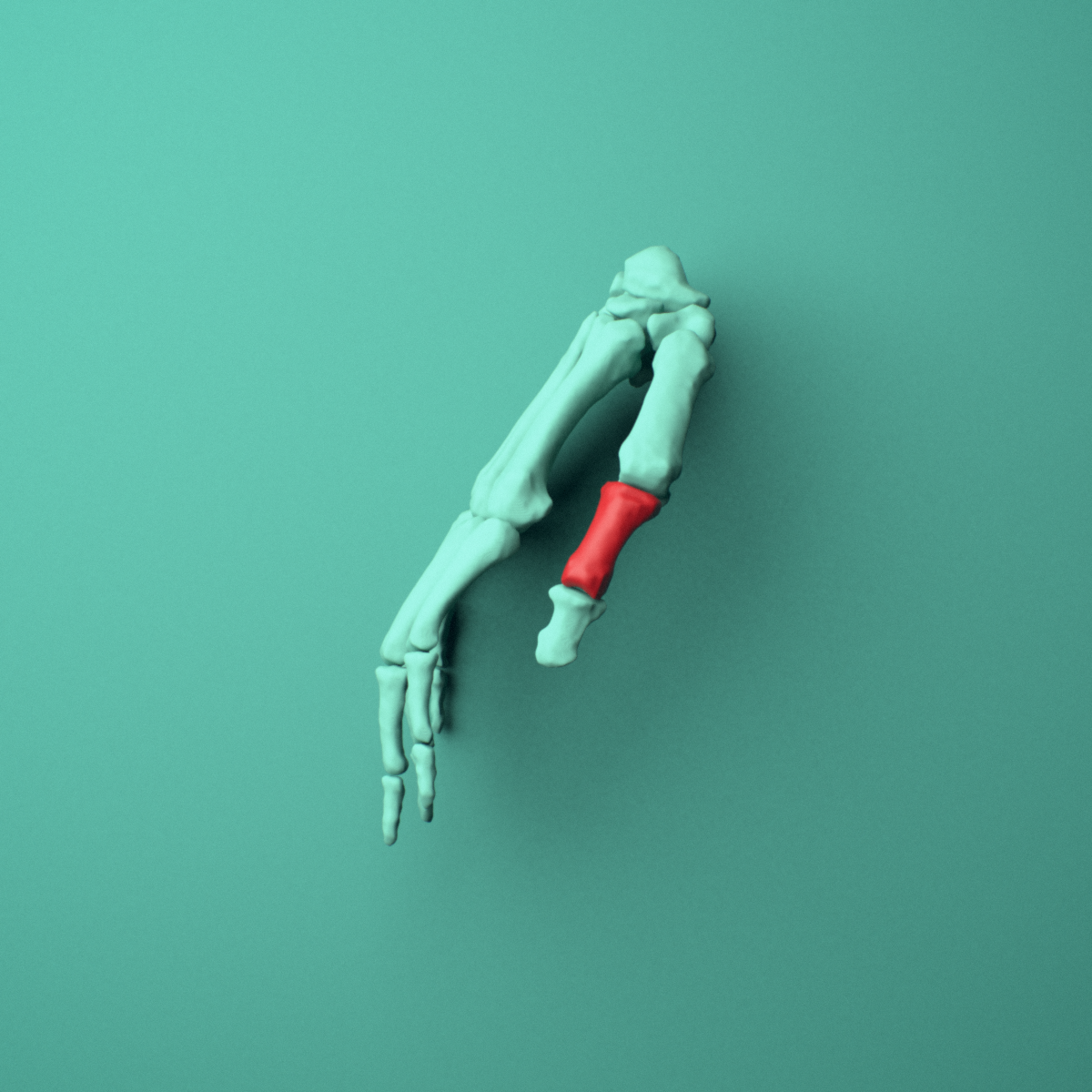 3D model of the Right thumb proximal phalanx shown in position within a full hand and wrist model, left lateral view.