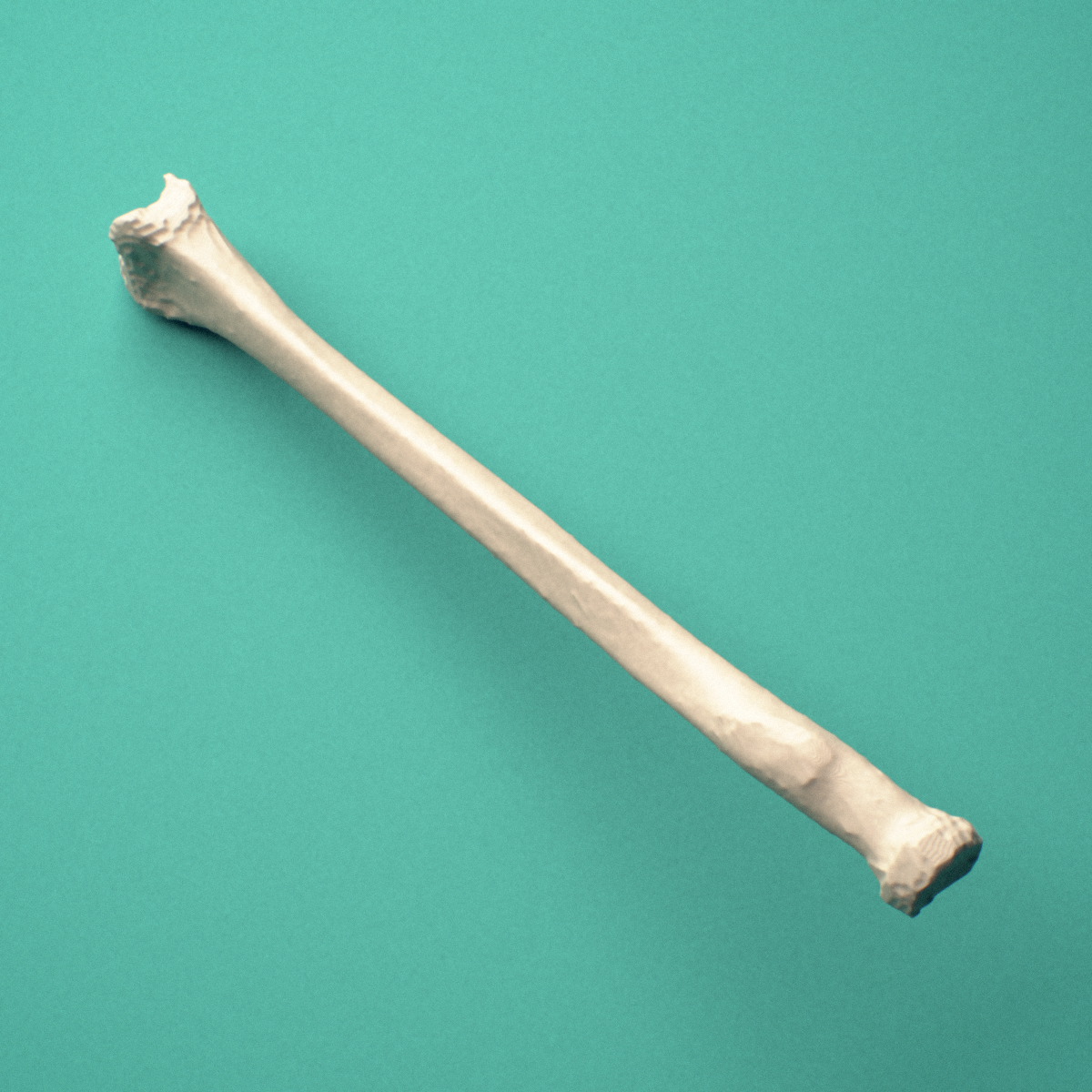 3D-printed Left radius, oblique close-up view showing the styloid process and ulnar notch.