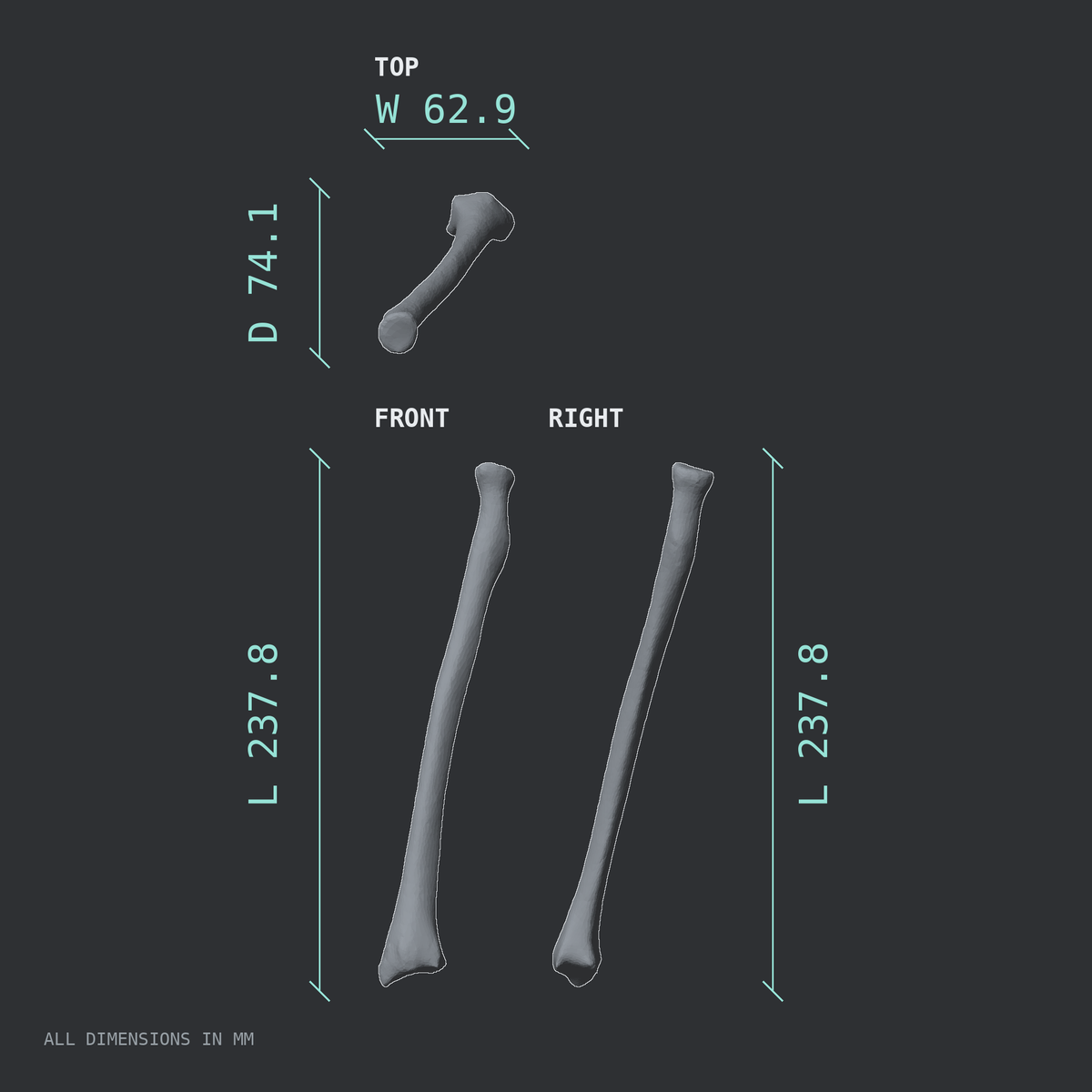 3D rendered dimensional drawing of the Left radius, top, front, and side views.