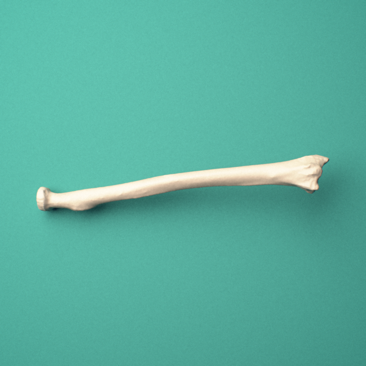 3D-printed Right radius, oblique view showing the radial head and neck and styloid process and ulnar notch.