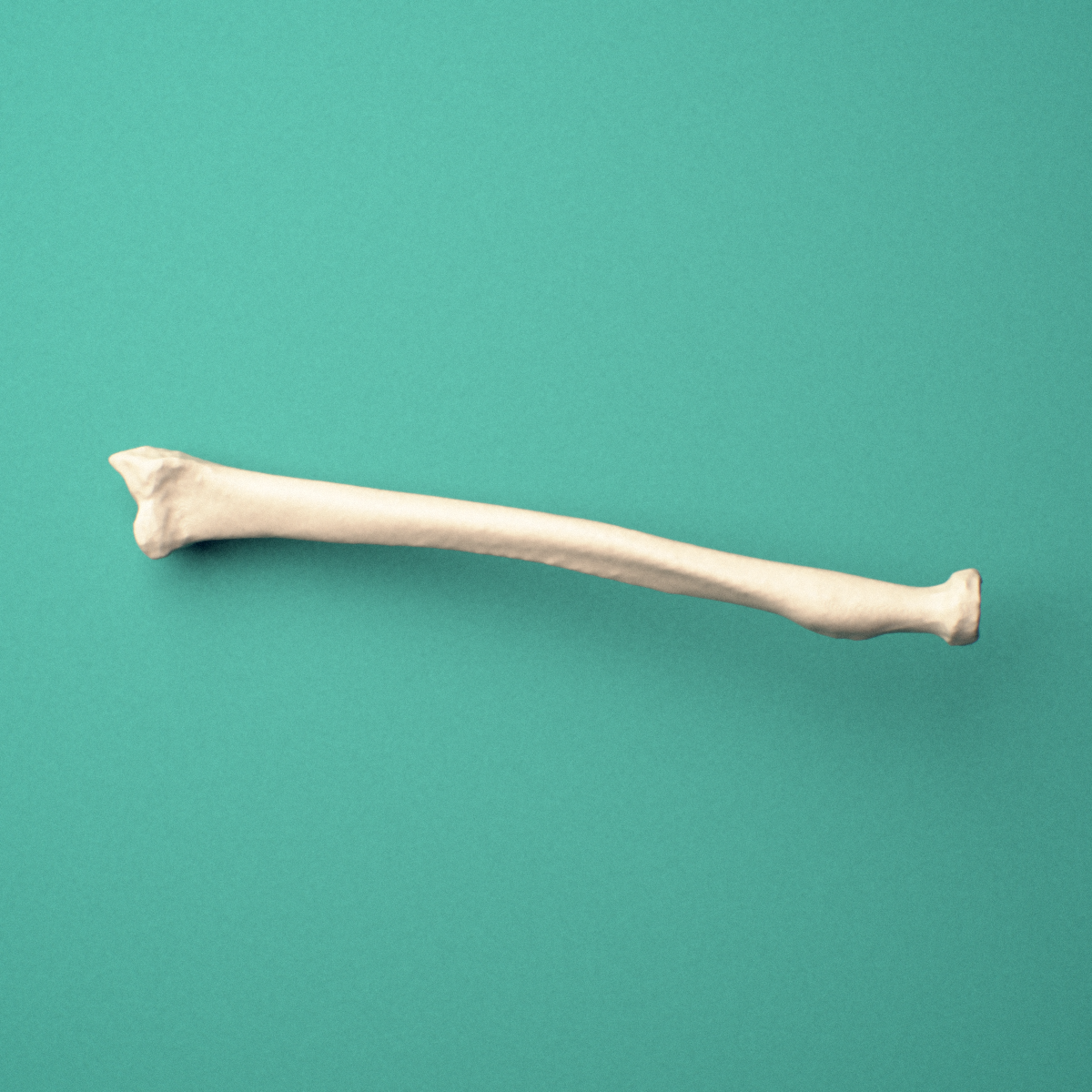 3D-printed Right radius, oblique close-up view showing the radial head and neck.