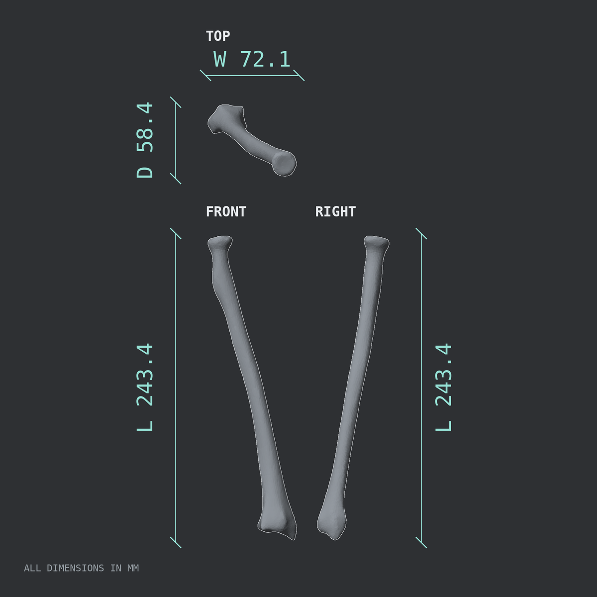 3D rendered dimensional drawing of the Right radius, top, front, and side views.