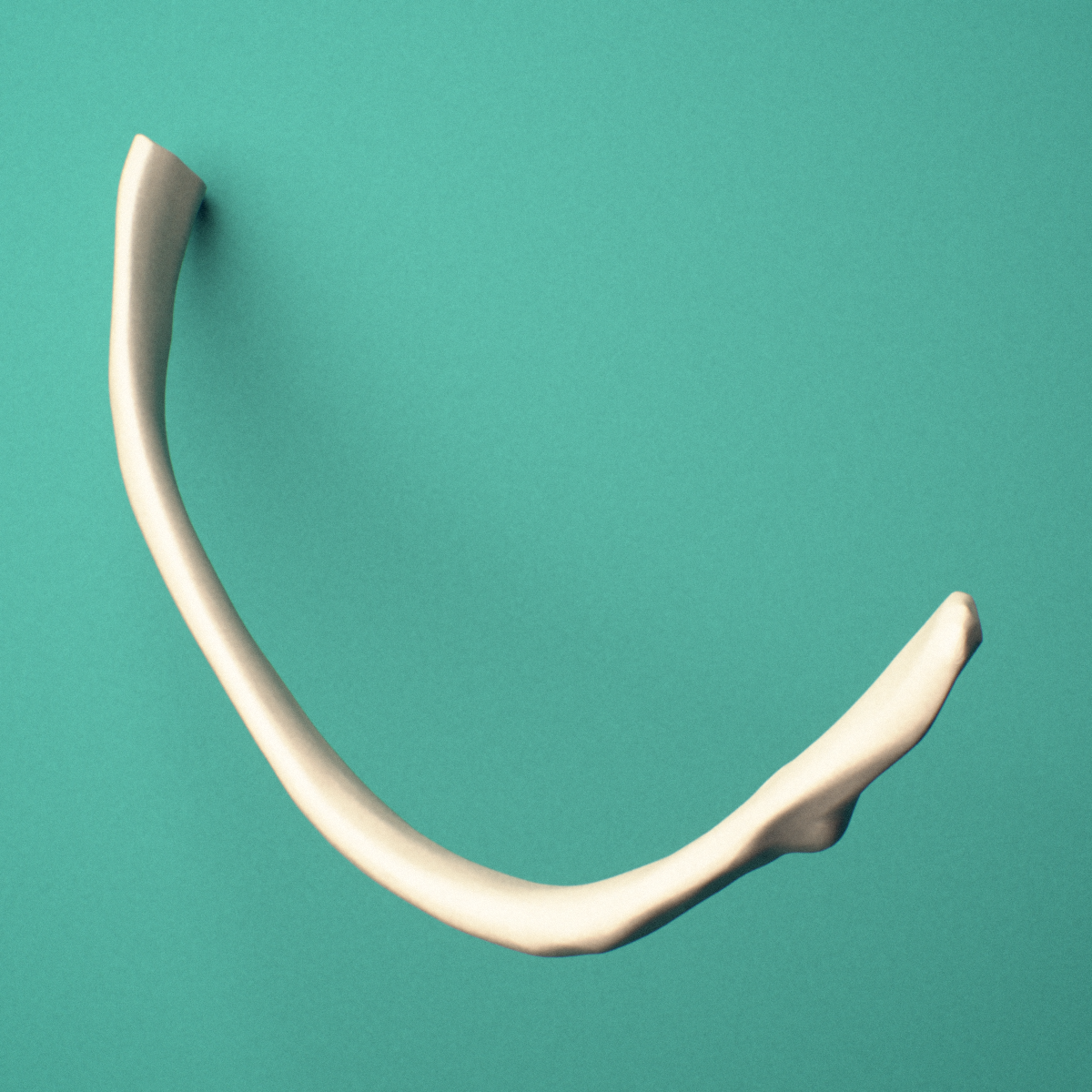3D-printed Left tenth rib (false rib), oblique view showing the overall curvature of the rib.
