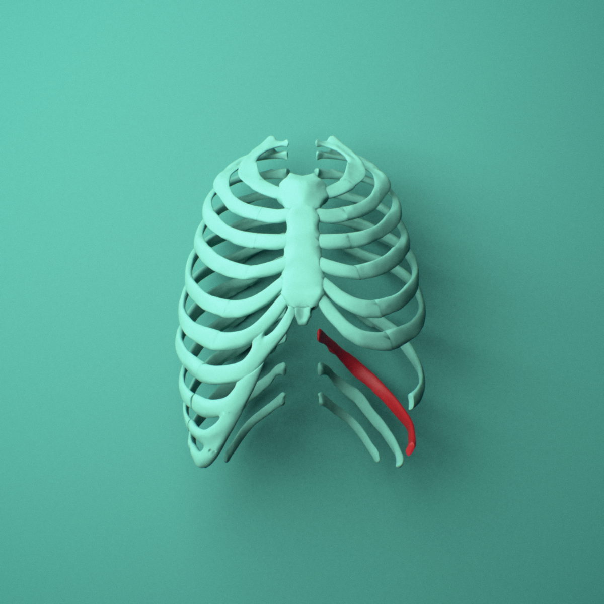 3D model of the Left tenth rib (false rib) shown in position within a full rib cage model, anterior view.