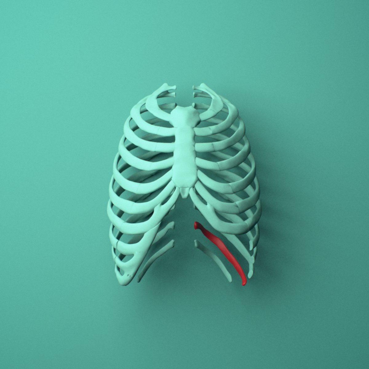 3D model of the Left eleventh rib (floating rib) shown in position within a full rib cage model, anterior view.