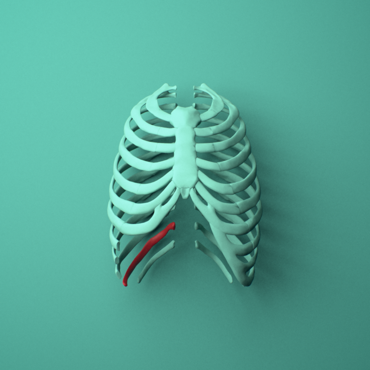 3D model of the Right eleventh rib (floating rib) shown in position within a full rib cage model, anterior view.