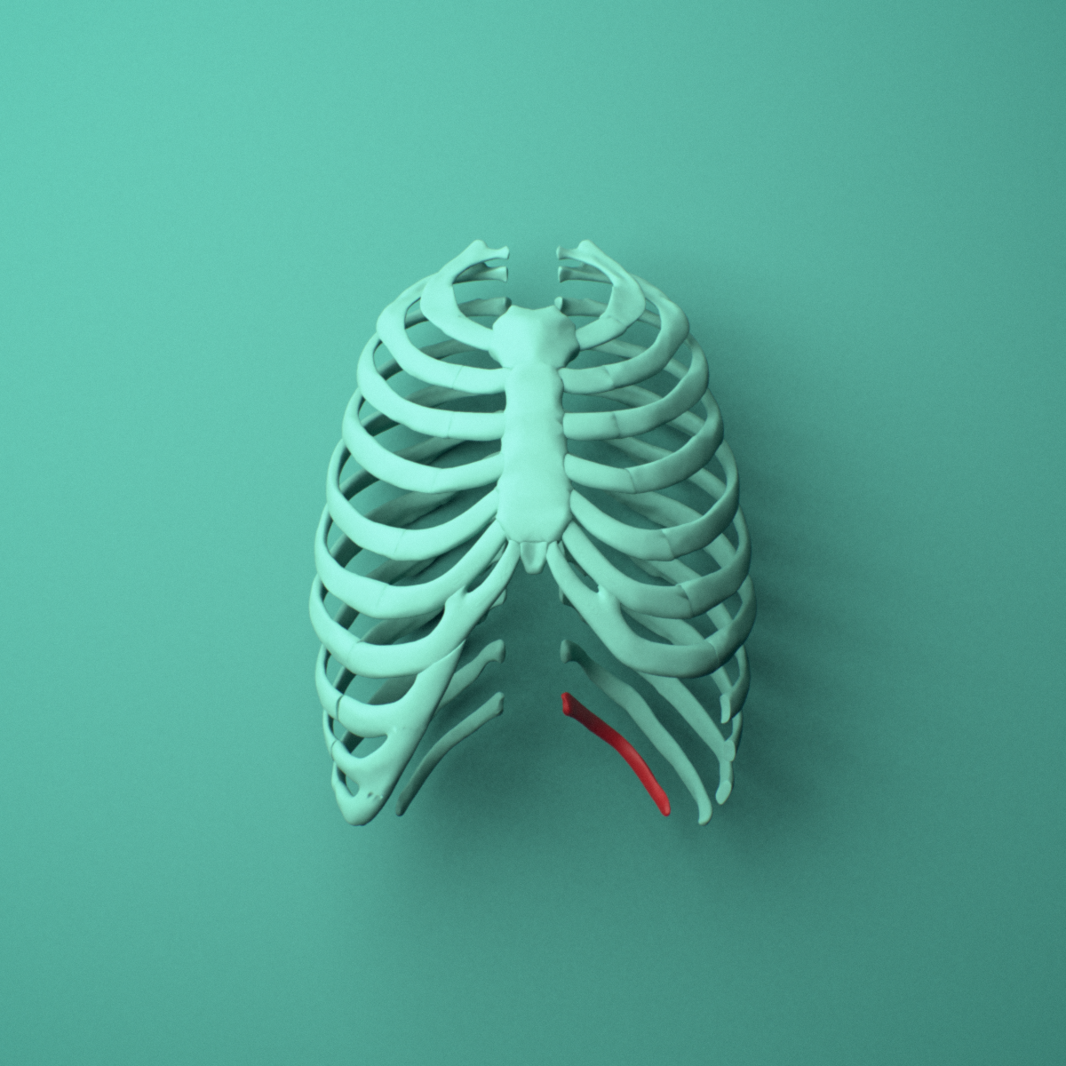 3D model of the Left twelfth rib (floating rib) shown in position within a full rib cage model, anterior view.
