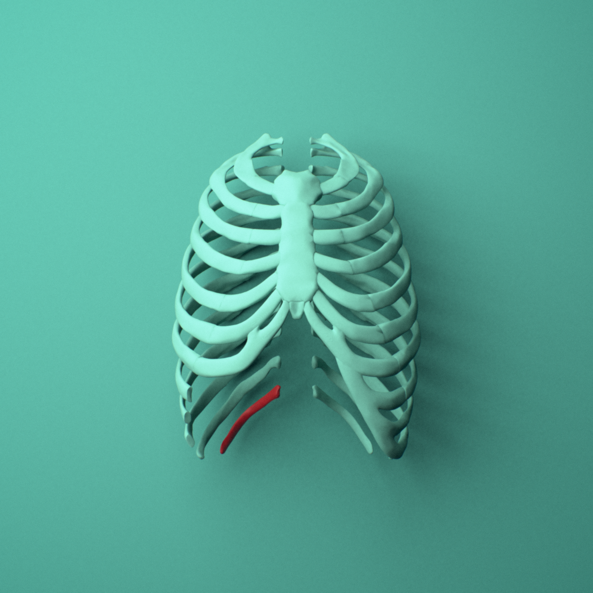 3D model of the Right twelfth rib (floating rib) shown in position within a full rib cage model, anterior view.
