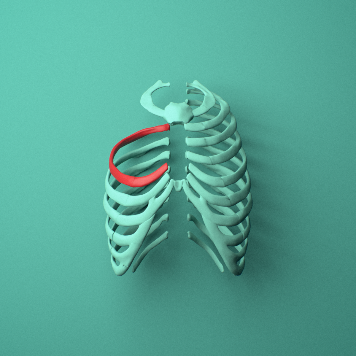 3D model of the Right fifth rib (true rib) shown in position within a full rib cage model, anterior view.