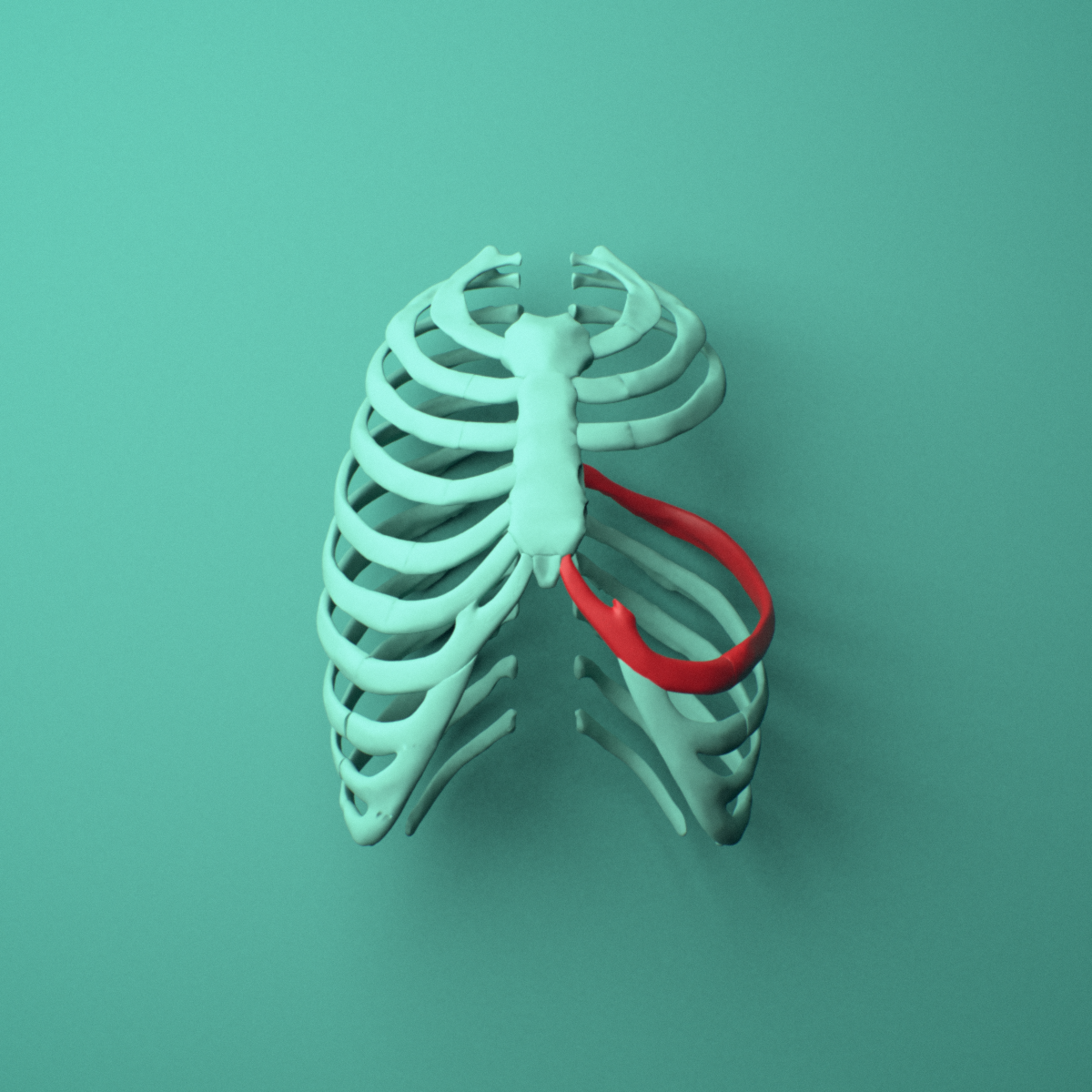 3D model of the Left seventh rib (true rib) shown in position within a full rib cage model, anterior view.