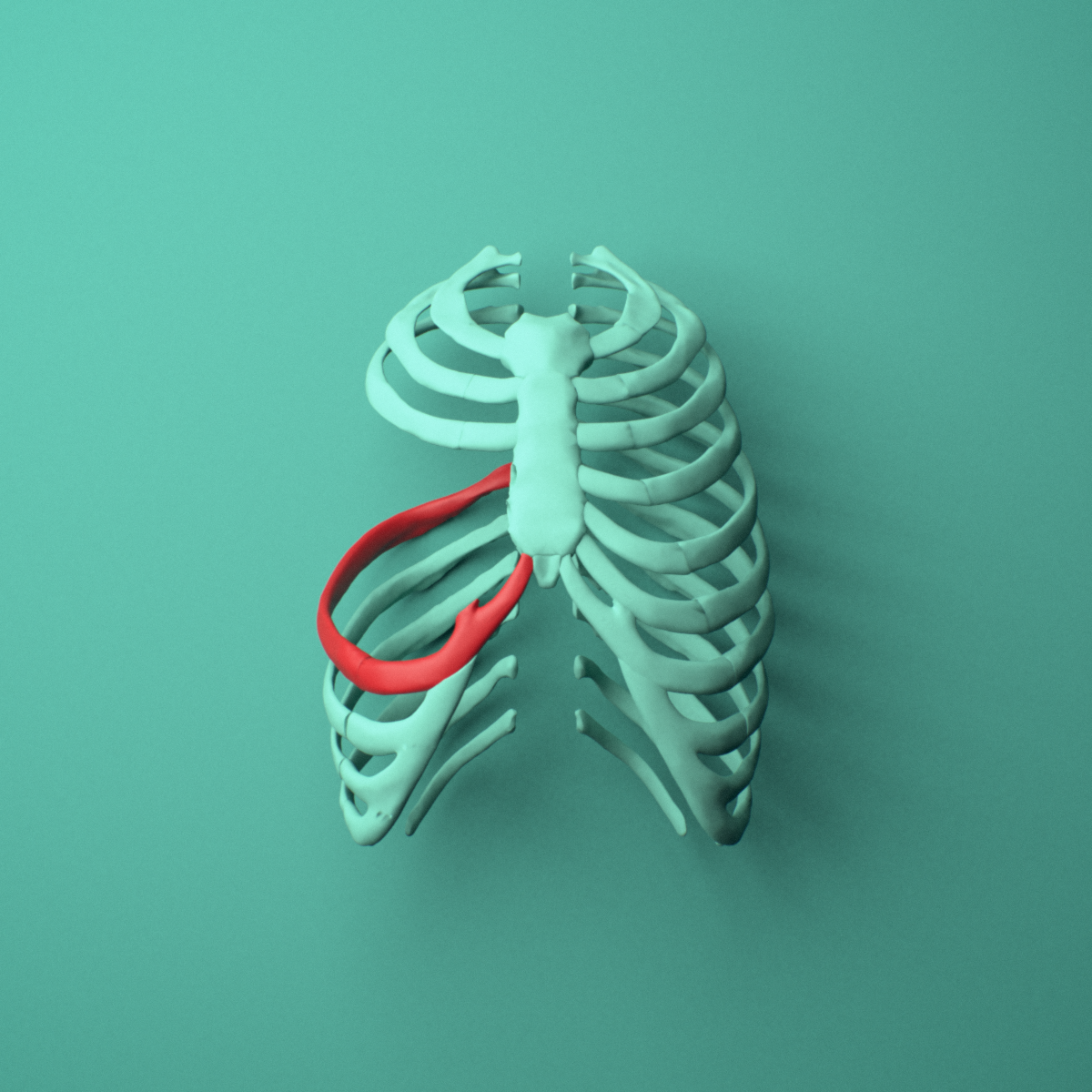 3D model of the Right seventh rib (true rib) shown in position within a full rib cage model, anterior view.
