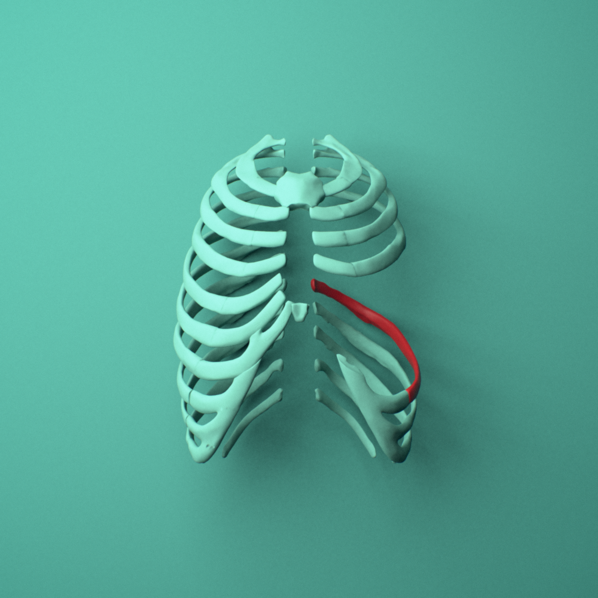 3D model of the Left eighth rib (false rib) shown in position within a full rib cage model, anterior view.