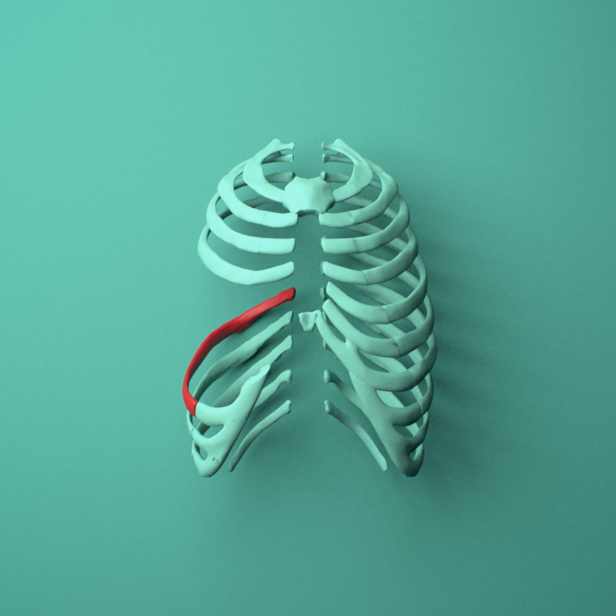 3D model of the Right eighth rib (false rib) shown in position within a full rib cage model, anterior view.