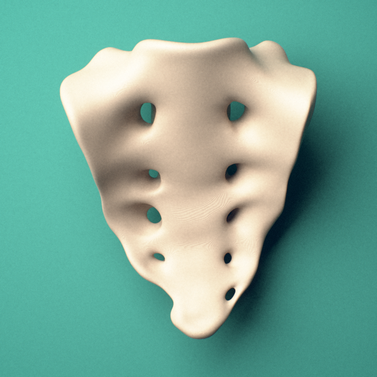 3D-printed Sacrum, male pelvis, posterior view showing the median sacral crest and posterior sacral foramina.