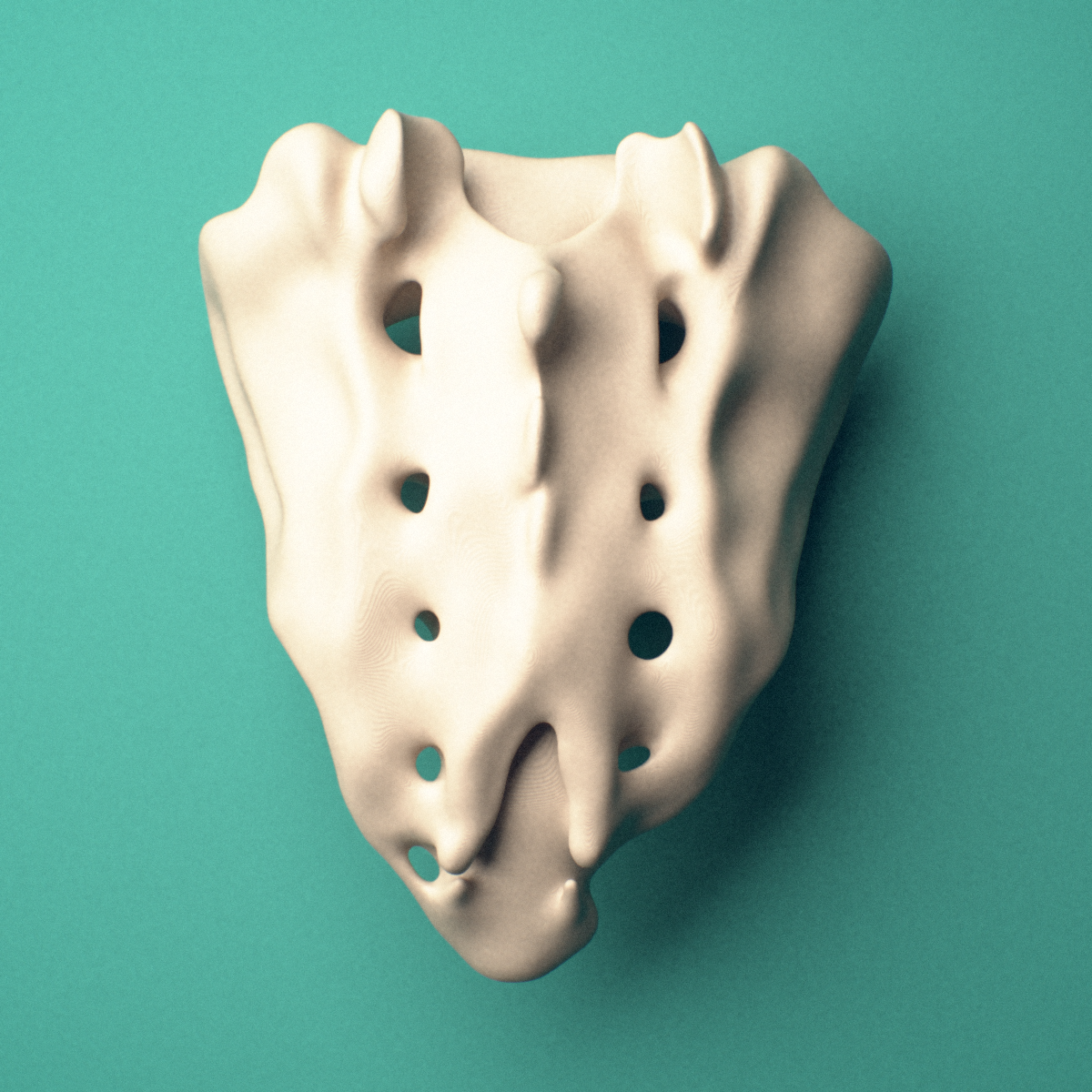 3D-printed Sacrum, male pelvis, lateral oblique view showing the ala and auricular surface.