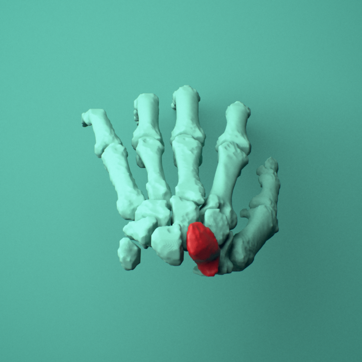 3D model of the Left scaphoid bone (wrist) shown in position within a full hand and wrist model, superior view.