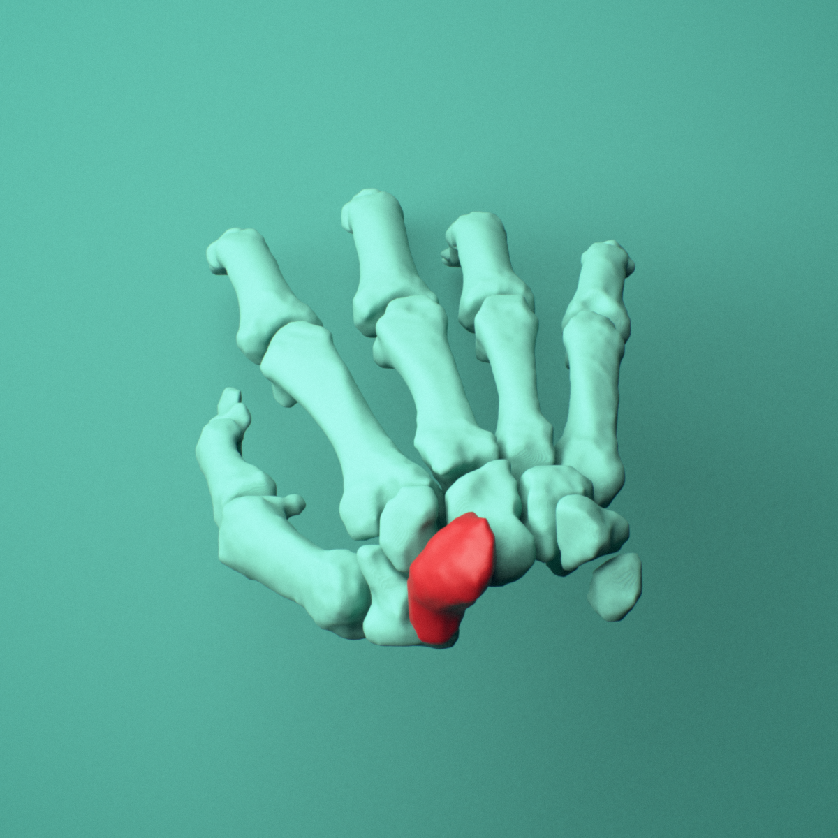 3D model of the Right scaphoid bone (wrist) shown in position within a full hand and wrist model, superior view.
