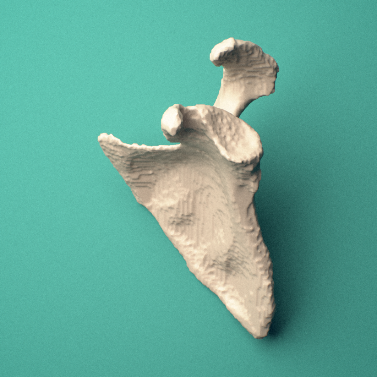 3D-printed Left scapula (shoulder blade), superior view showing the glenoid cavity and coracoid process.