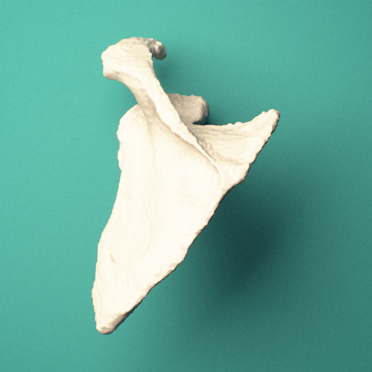 3D-printed Left scapula (shoulder blade), inferior view showing the acromion and scapular spine.