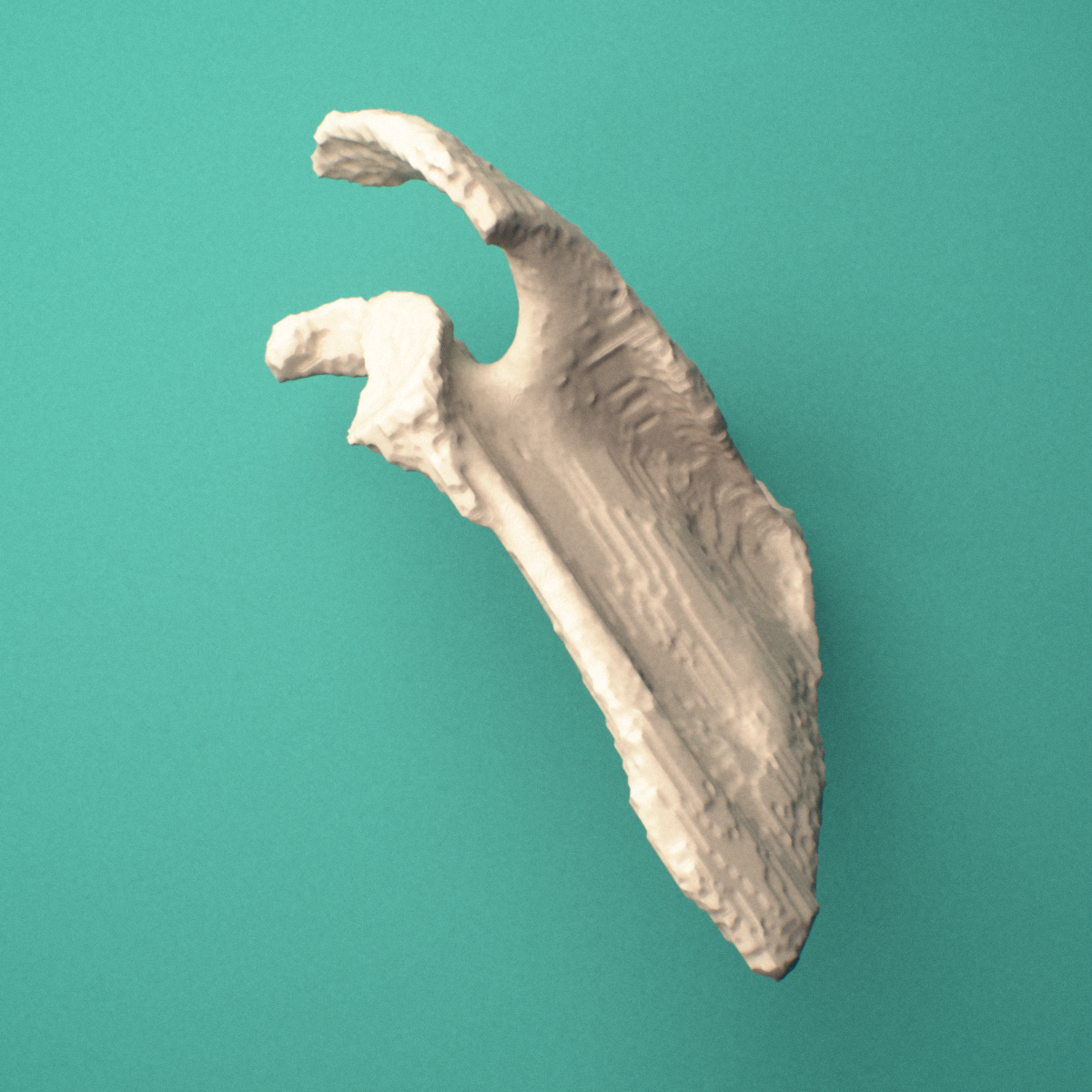 3D-printed Left scapula (shoulder blade), oblique close-up view showing the glenoid cavity and coracoid process.