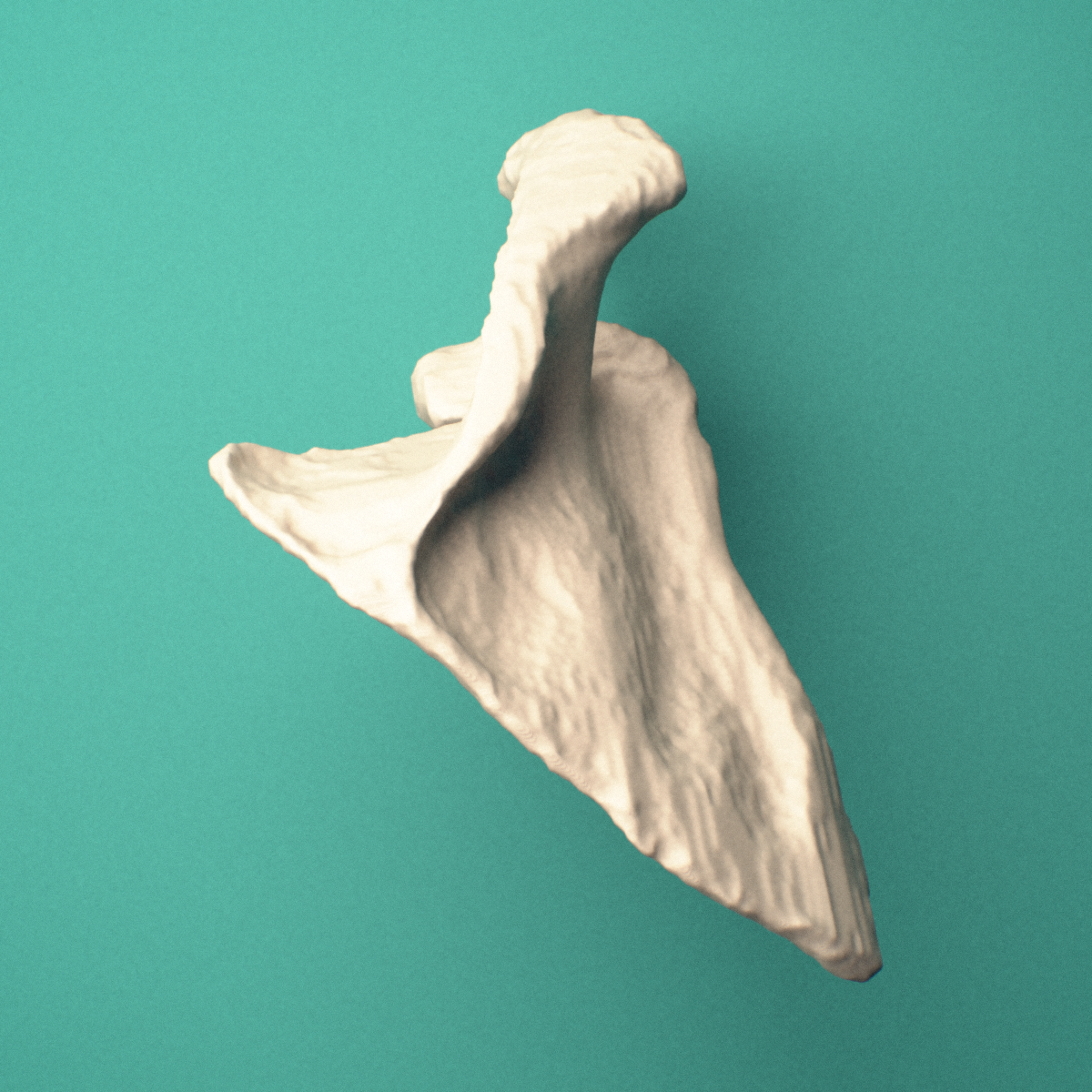 3D-printed Right scapula (shoulder blade), inferior view showing the acromion and scapular spine.