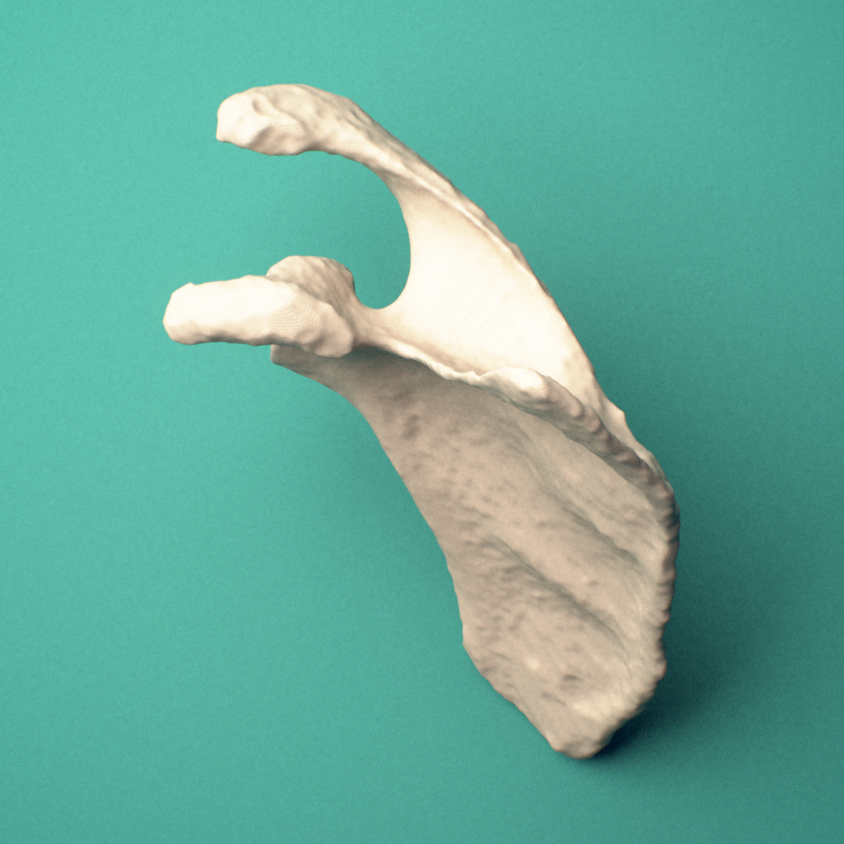 3D-printed Right scapula (shoulder blade), oblique close-up view showing the glenoid cavity and coracoid process.
