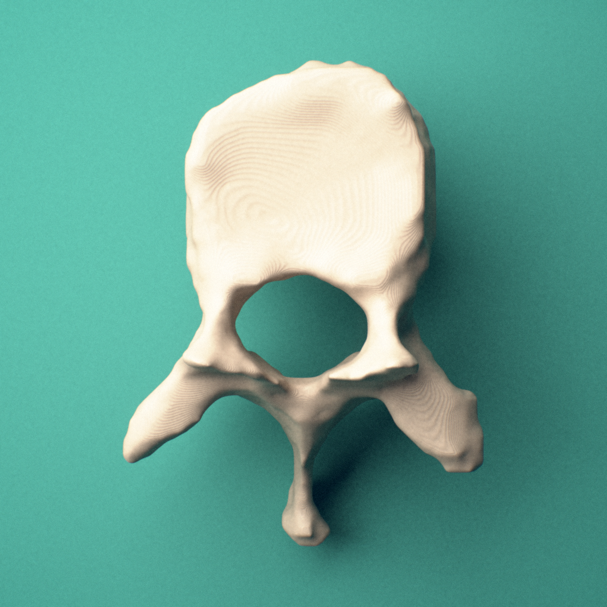 3D-printed T10 thoracic vertebra, superior view showing the vertebral body and vertebral foramen.