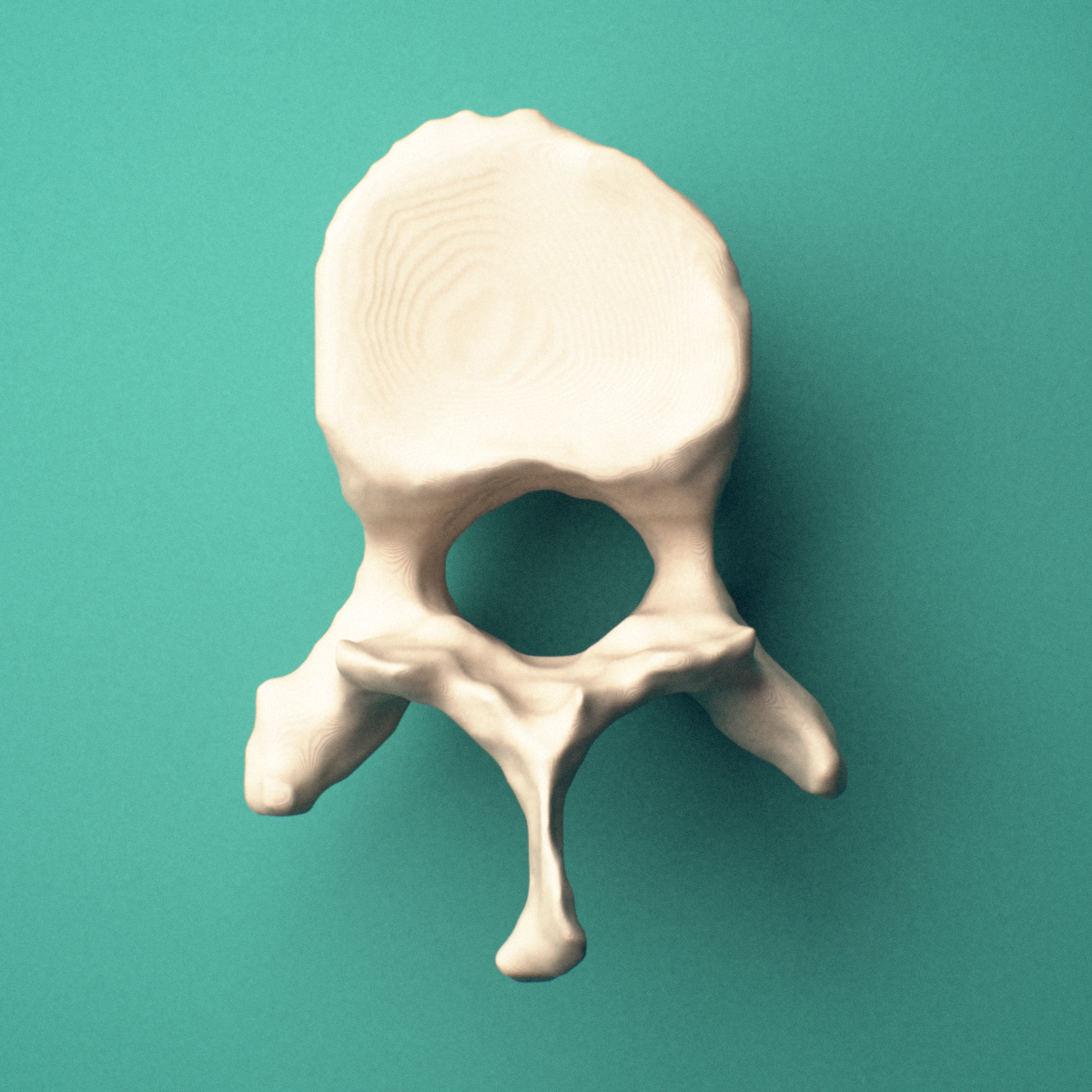 3D-printed T10 thoracic vertebra, superior oblique view showing the spinous process and superior costal facets.