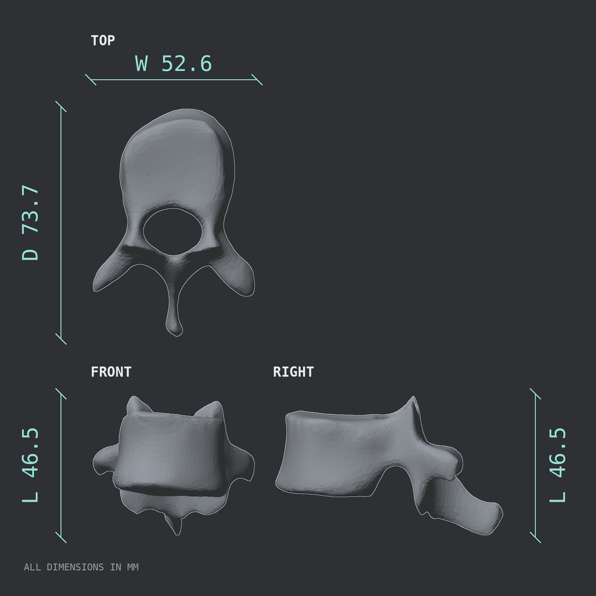 3D rendered dimensional drawing of the T10 thoracic vertebra, top, front, and side views.