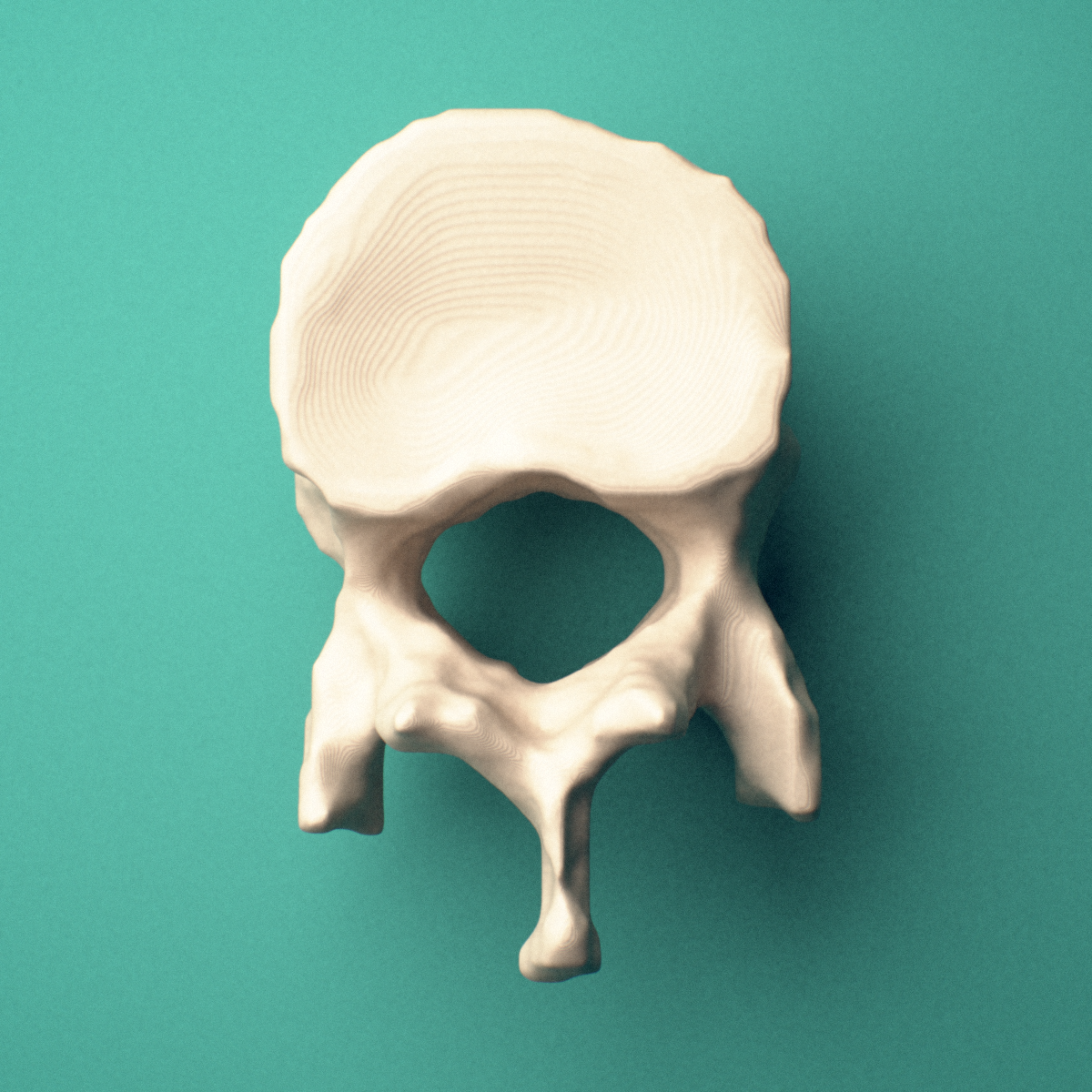 3D-printed T11 thoracic vertebra, superior oblique view showing the spinous process and superior costal facets.