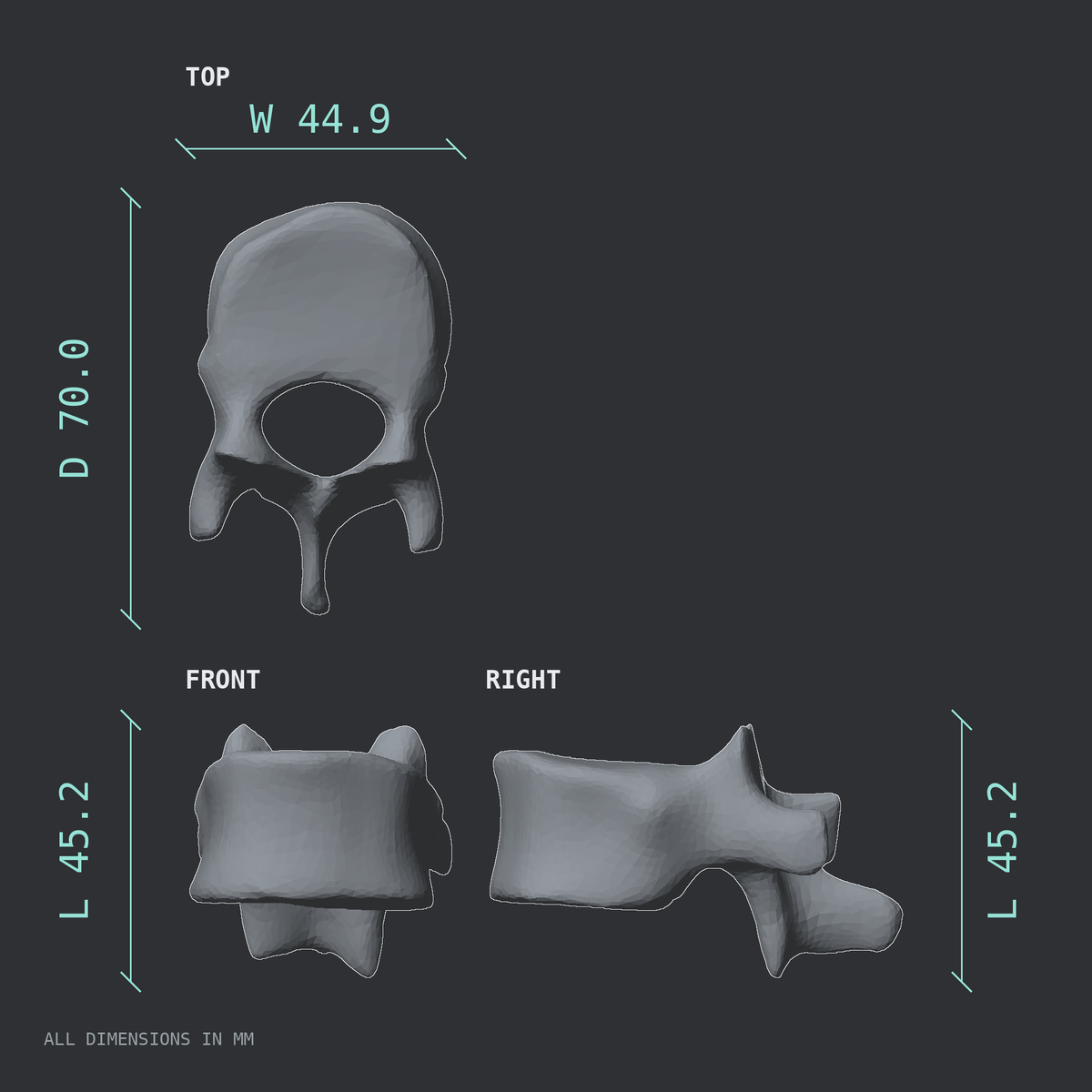 3D rendered dimensional drawing of the T11 thoracic vertebra, top, front, and side views.
