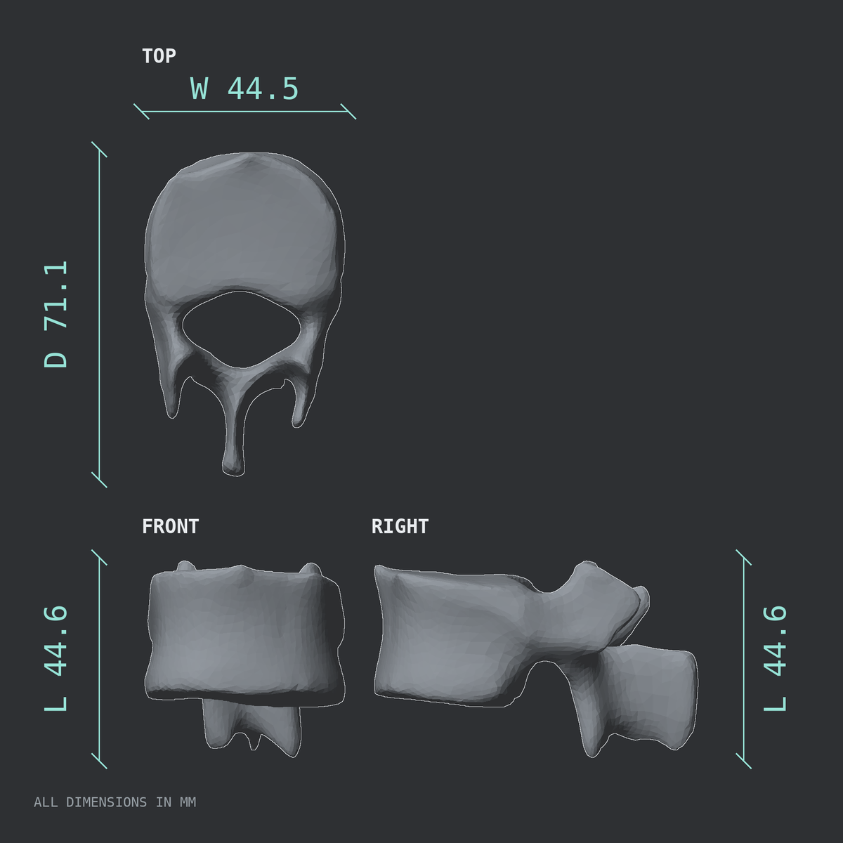 3D rendered dimensional drawing of the T12 thoracic vertebra, top, front, and side views.