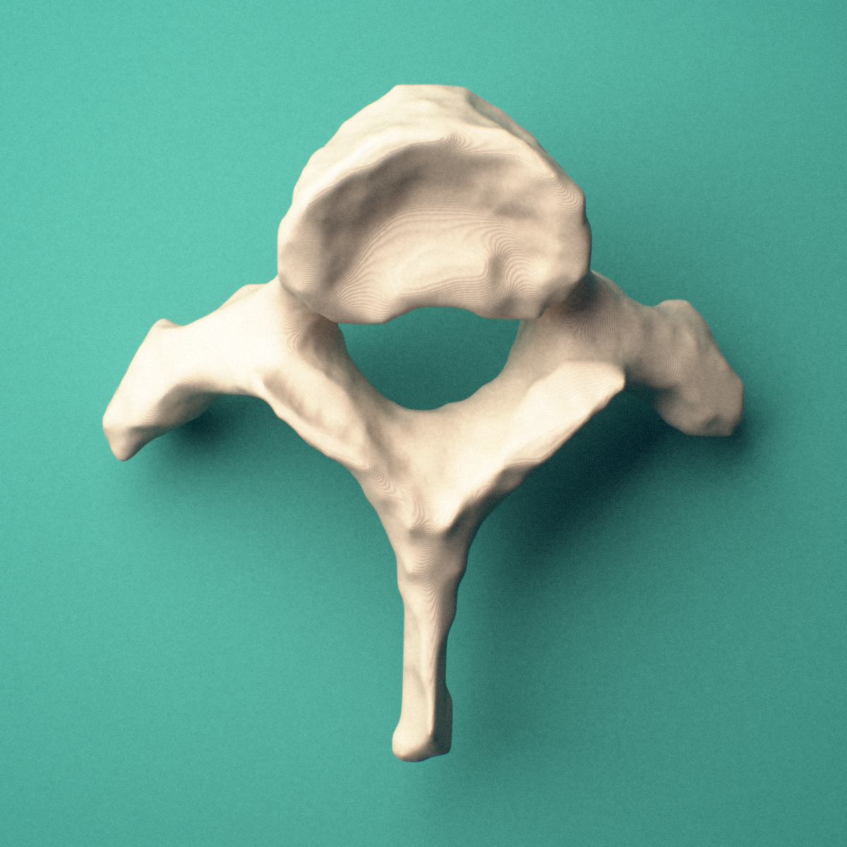 3D-printed T1 thoracic vertebra, superior oblique view showing the spinous process and superior costal facets.