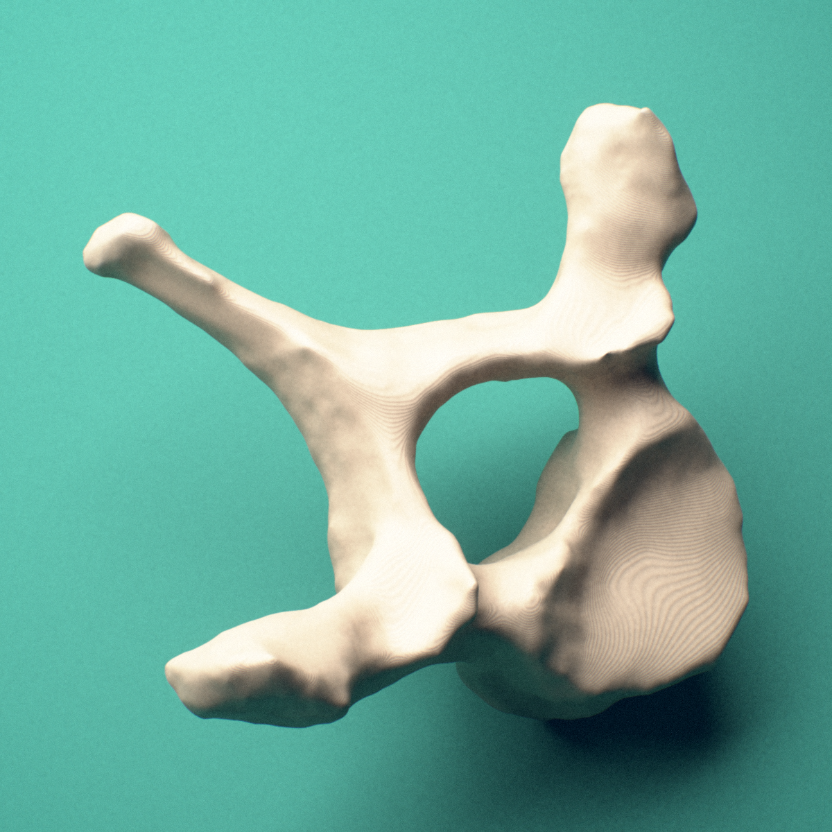 3D-printed T1 thoracic vertebra, posterior oblique view showing the laminae and spinous process.