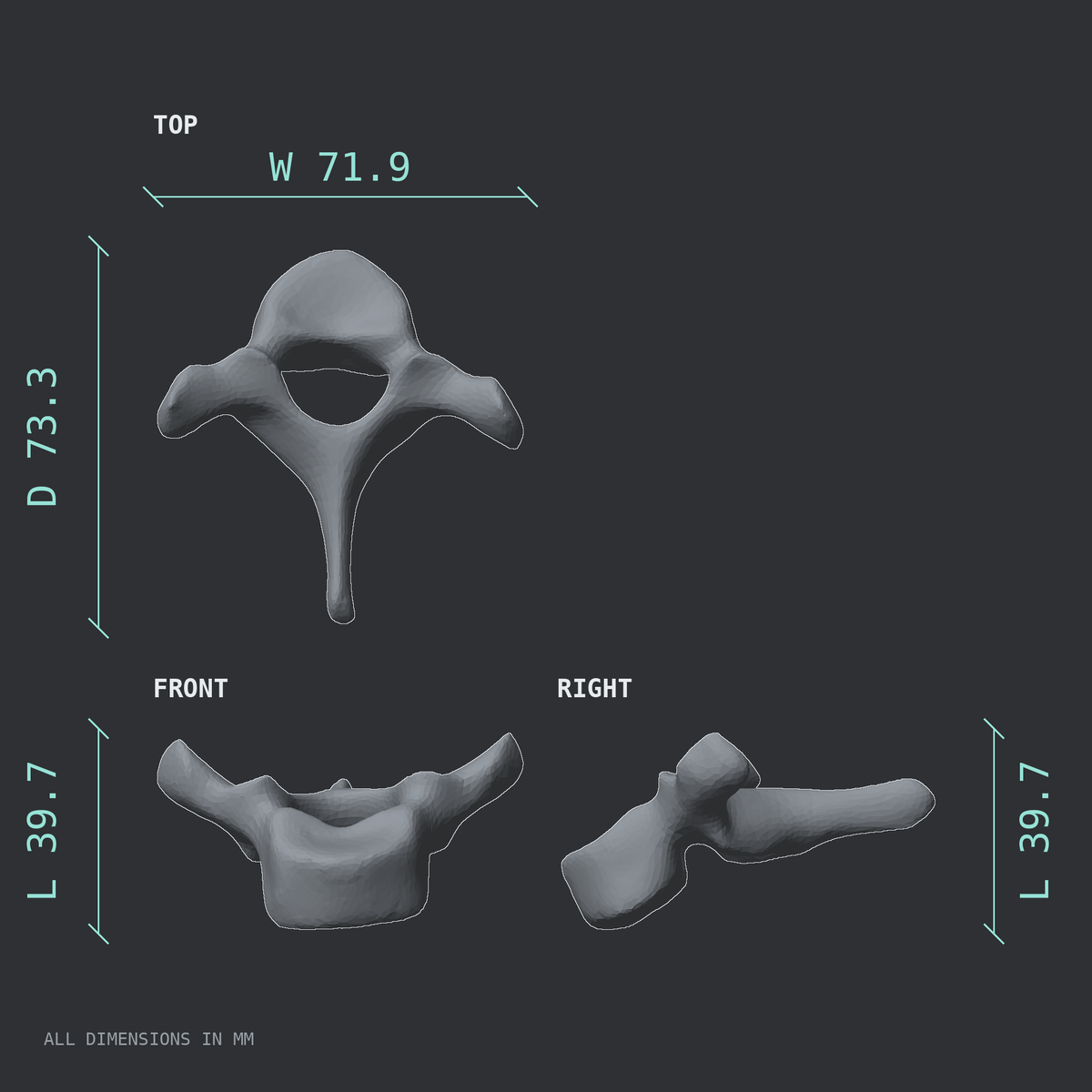 3D rendered dimensional drawing of the T1 thoracic vertebra, top, front, and side views.