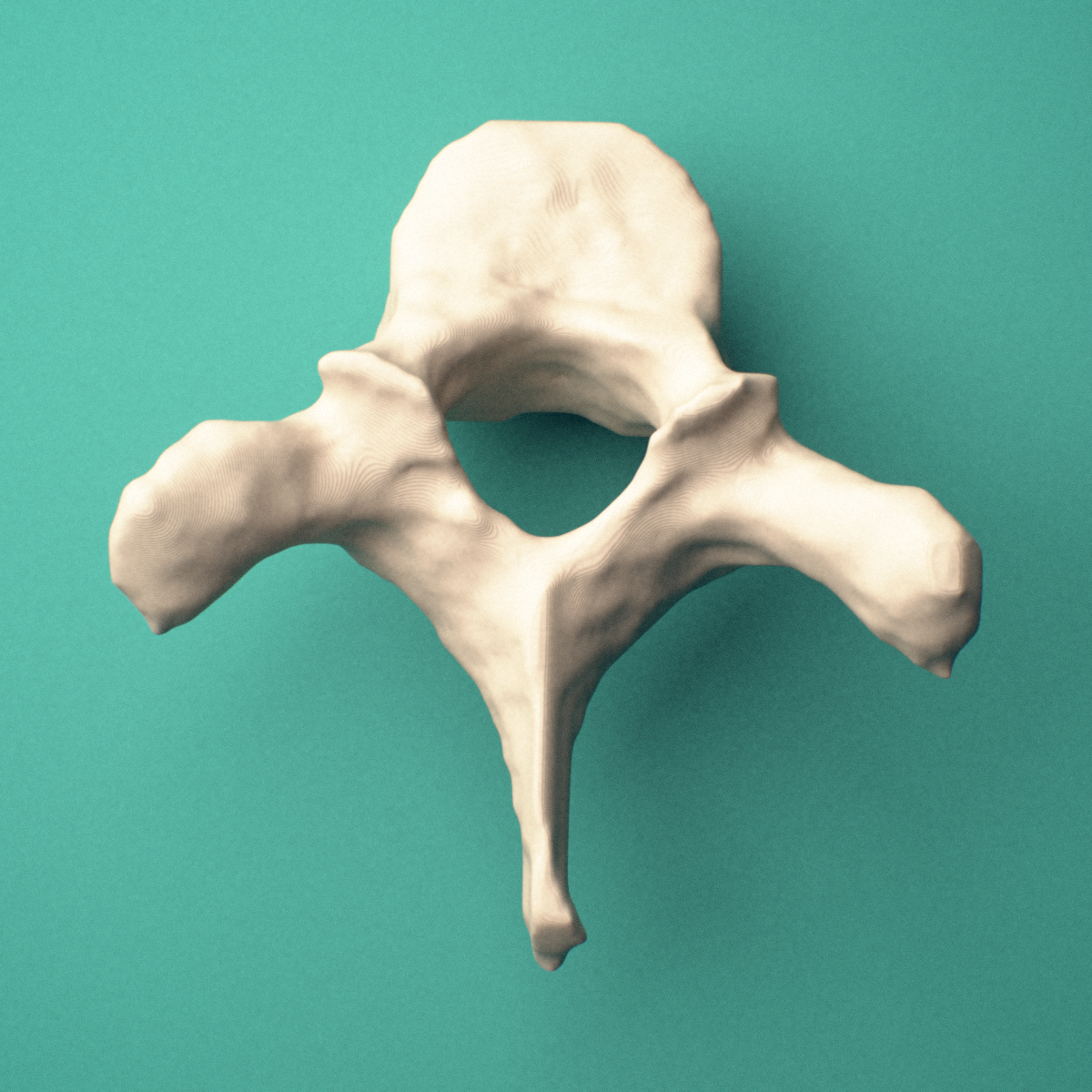 3D-printed T2 thoracic vertebra, superior view showing the vertebral body and vertebral foramen.