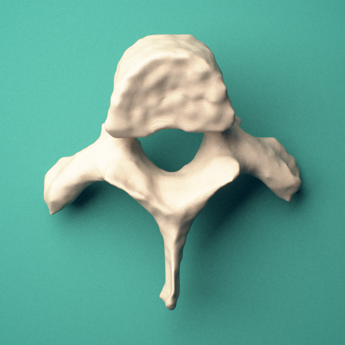 3D-printed T2 thoracic vertebra, superior oblique view showing the spinous process and superior costal facets.