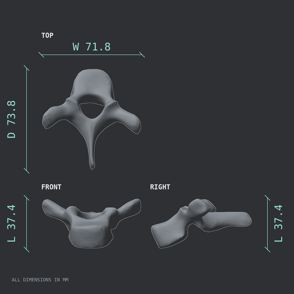 3D rendered dimensional drawing of the T2 thoracic vertebra, top, front, and side views.