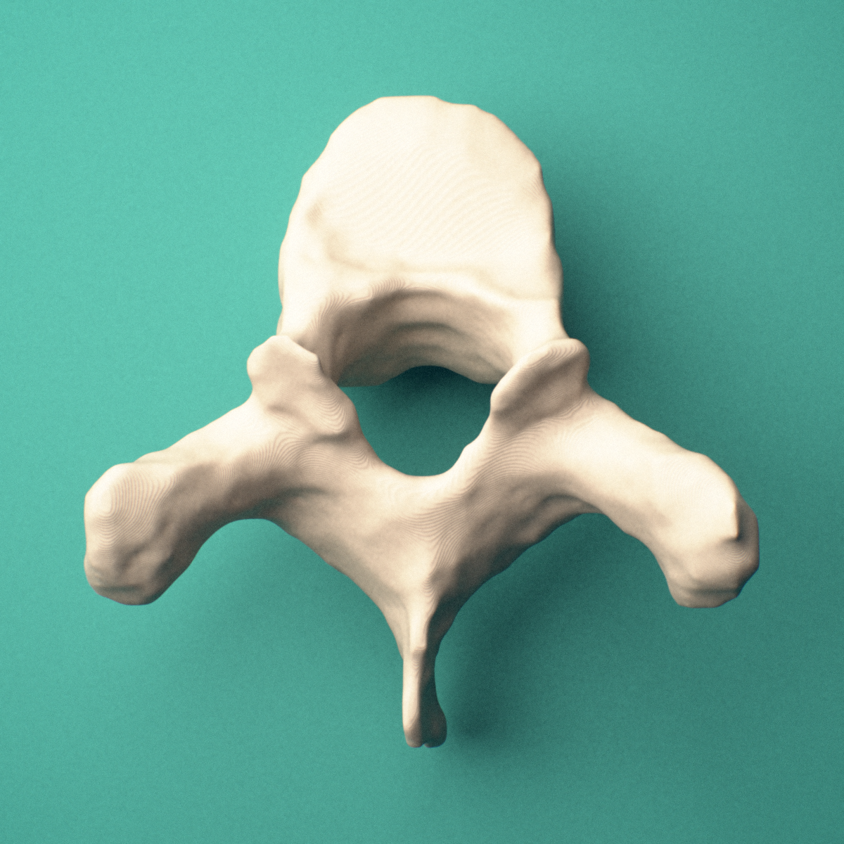 3D-printed T3 thoracic vertebra, superior view showing the vertebral body and vertebral foramen.