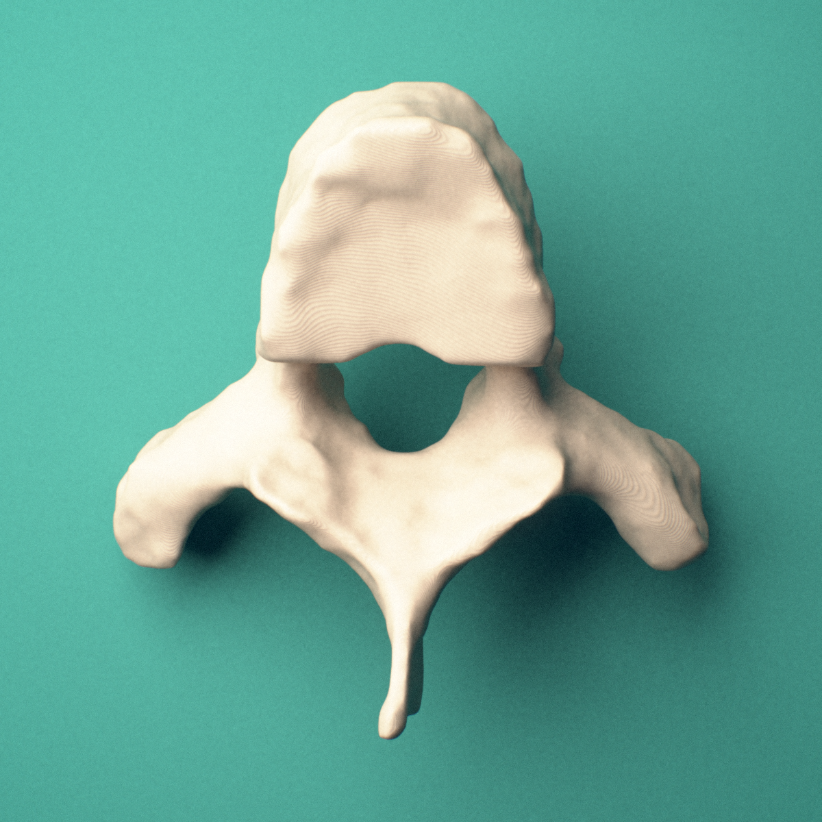 3D-printed T3 thoracic vertebra, superior oblique view showing the spinous process and superior costal facets.