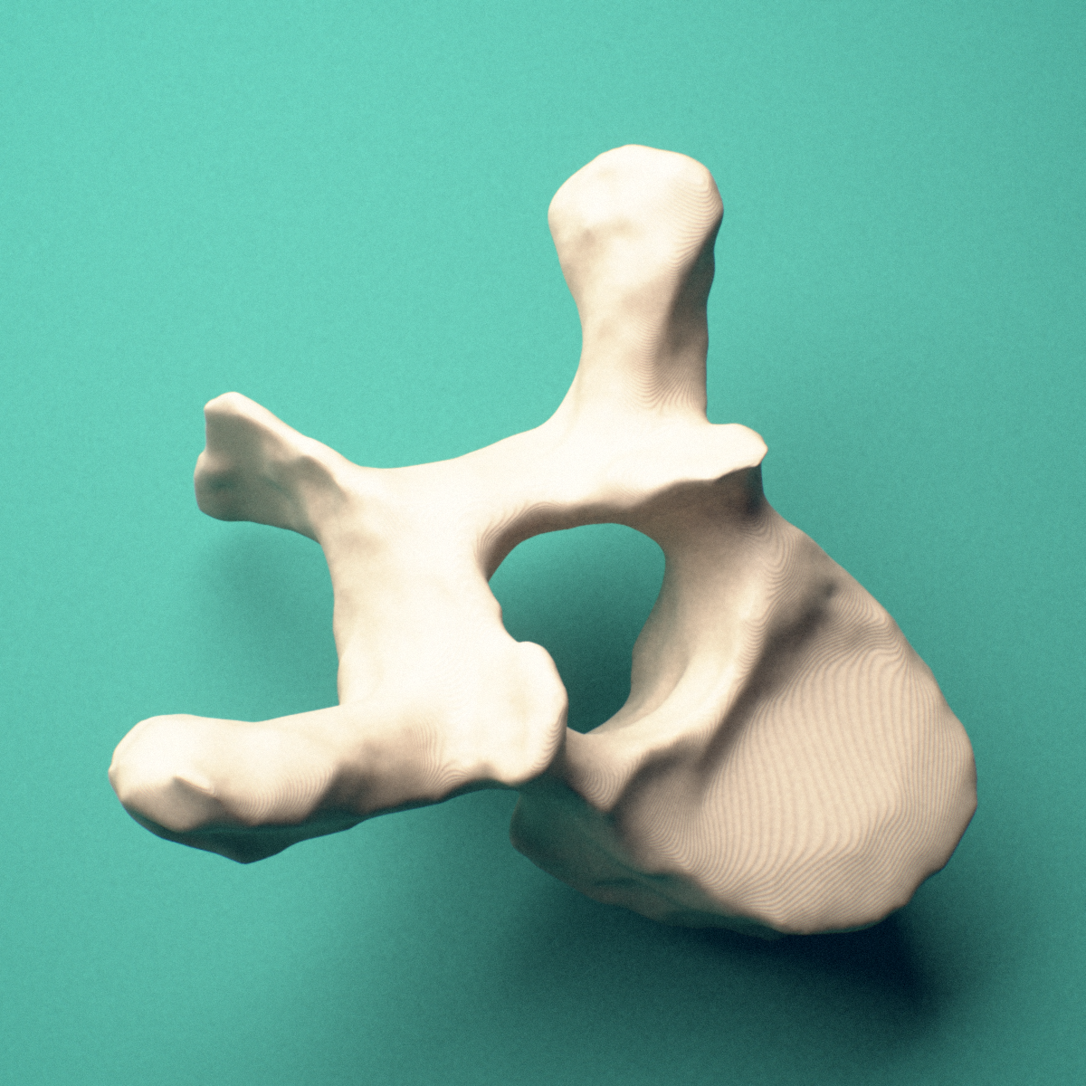 3D-printed T3 thoracic vertebra, posterior oblique view showing the laminae and spinous process.